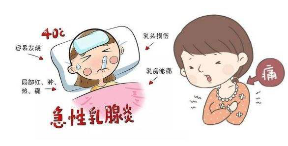 急性乳腺炎健康教育处方